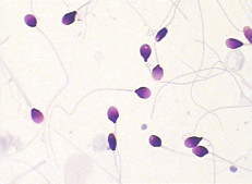 Morfologia dello sperma BRED-015 che macchia metodo di Kit Diff Quik Rapid Staining