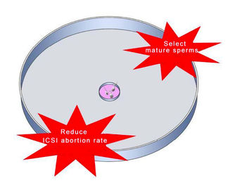 Il piatto di selezione dello sperma dell'acido ialuronico per ICSI IVF riduce il tasso di perdita di gravidanza