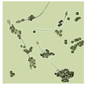 Kit For Determination di IgA Antibody Coating Spermatozoa (MARZO)