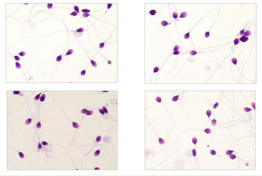 Kit di colorazione Diff Quik pronto all'uso Kit di colorazione Quik differenziale per la morfologia degli spermatozoi