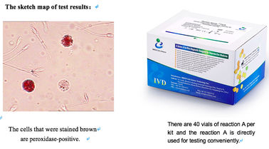 Kit per il test dei leucociti del campione di sperma 40T/Kit per lo screening delle infezioni del tratto riproduttivo maschile