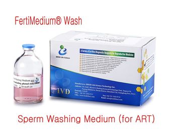 Medium di consumo CRESCIUTO di lavaggio dello sperma del piatto IVF IUI di selezione dello sperma per ARTE