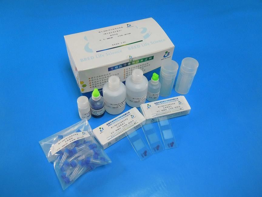 Kit di prova per la frammentazione del DNA dello sperma di Wright con metodo SCD per 40 test/Kit nei laboratori di andrologia
